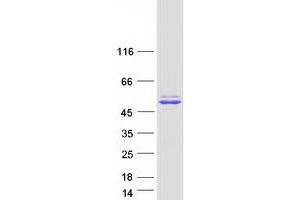 Validation with Western Blot