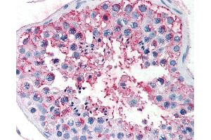 Anti-FSHR antibody IHC of human testis.