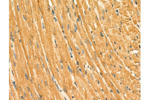 ABIN6264894 and ABIN6266632 at 1/100 staining Rat heart tissue by IHC-P. (S100A1 anticorps  (N-Term))