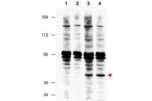 Western blot using FANCF polyclonal antibody  shows detection of FANCF present in a lysate prepared from a Fanconi anemia complementation group F patient lymphoblast after retroviral correction using hFANCF cDNA (lanes 3 and 4). (FANCF anticorps  (Internal Region))