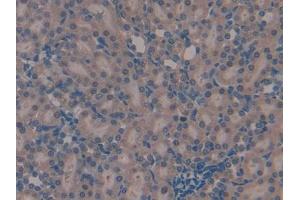 Used in DAB staining on fromalin fixed paraffin- embedded kidney tissue
