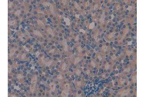 Used in DAB staining on fromalin fixed paraffin- embedded kidney tissue (TMSB4X anticorps  (AA 1-44))