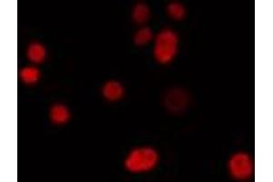 ABIN6274302 staining LOVO cells by IF/ICC. (IRX1 anticorps  (Internal Region))
