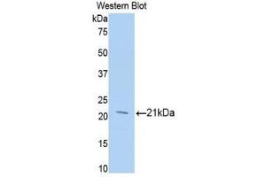 Western Blotting (WB) image for anti-Meningioma Expressed Antigen 5 (Hyaluronidase) (MGEA5) (AA 271-438) antibody (ABIN1859958) (MGEA5 anticorps  (AA 271-438))