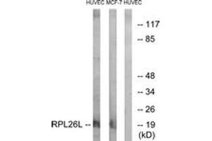 Western blot analysis of extracts from HuvEc/MCF-7 cells, using RPL26L Antibody. (RPL26L anticorps  (AA 96-145))