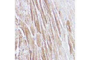 Immunohistochemistry of paraffin-embedded mouse heart using NPPA Rabbit pAb (ABIN7268829) at dilution of 1:100 (40x lens).