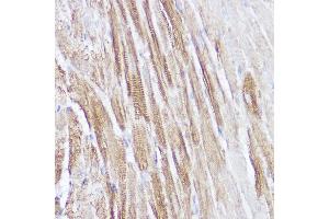 Immunohistochemistry of paraffin-embedded mouse heart using NPPA Rabbit pAb (ABIN7268829) at dilution of 1:100 (40x lens). (NPPA anticorps  (AA 26-151))