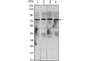 Western blot analysis using CHUK mouse mAb against Raji (1), Jurkat (2), THP-1 (3) and K562 (4) cell lysate. (IKK alpha anticorps)