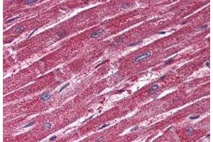 Immunohistochemistry (Formalin/PFA-fixed paraffin-embedded sections) of human heart tissue with TRPM4 polyclonal antibody . (TRPM4 anticorps  (N-Term))