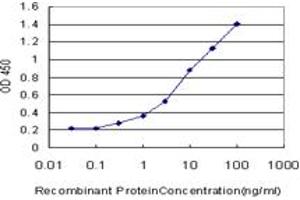 Detection limit for recombinant GST tagged CPT2 is approximately 0.