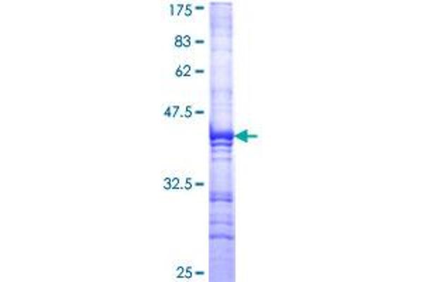 XPC Protein (AA 141-250) (GST tag)