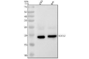 Western blot analysis of SOCS2 using anti-SOCS2 antibody (ABIN7606342).