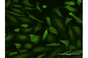 Immunofluorescence of purified MaxPab antibody to MALT1 on HeLa cell.