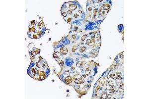 Immunohistochemistry of paraffin-embedded human placenta using Alpha-2-Macroglobulin (Alpha-2-Macroglobulin (M)) Rabbit mAb (ABIN7265558) at dilution of 1:100 (40x lens).