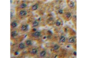 Used in DAB staining on fromalin fixed paraffin-embedded Liver tissue (TFPI anticorps  (AA 29-210))