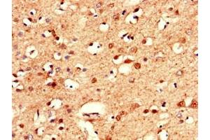 Immunohistochemistry of paraffin-embedded human brain tissue using ABIN7146589 at dilution of 1:100 (Calsyntenin 2 anticorps  (AA 473-673))
