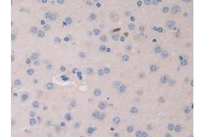 Detection of HPSE in Mouse Cerebrum Tissue using Polyclonal Antibody to Heparanase (HPSE)