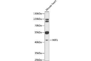 Western blot analysis of extracts of mouse heart, using WIF1 antibody (ABIN6128926, ABIN6150217, ABIN6150219 and ABIN6216799) at 1:1000 dilution. (WIF1 anticorps  (AA 29-220))