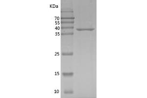 JNK Protein (AA 2-383) (His tag)