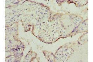 Immunohistochemistry of paraffin-embedded human placenta tissue using ABIN7150790 at dilution of 1:100 (TESK2 anticorps  (AA 302-571))