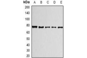 Western blot analysis of PRPF3 expression in A549 (A), HepG2 (B), THP1 (C), mouse spleen (D), mouse testis (E) whole cell lysates. (PRPF3 anticorps)
