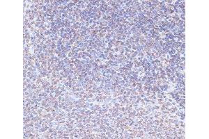 Immunohistochemistry of paraffin-embedded Rat spleen using SNW1 Polyclonal Antibody at dilution of 1:100 (40x lens).