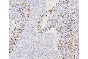 IHC analysis of FLNA using anti-FLNA antibody (ABIN7601782).