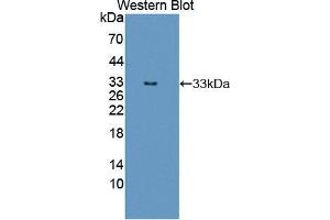 Western blot analysis of the recombinant protein. (ERBB3 anticorps  (AA 709-966))
