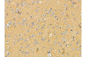 Nestin Mouse Monoclonal Antibody at 1/100 staining rat brain tissue by IHC-P. (Nestin anticorps  (C-Term))