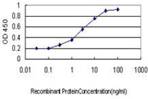 Detection limit for recombinant GST tagged SERPINB3 is approximately 0.