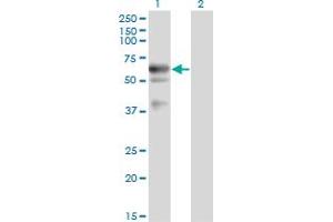 Western Blot analysis of LIPG expression in transfected 293T cell line by LIPG monoclonal antibody (M02), clone 1E11. (LIPG anticorps  (AA 21-500))