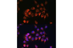 Immunofluorescence analysis of HeLa cells using BDKRB2 Rabbit pAb (ABIN3016822, ABIN3016823, ABIN3016824 and ABIN6219849) at dilution of 1:100. (BDKRB2 anticorps  (AA 302-391))