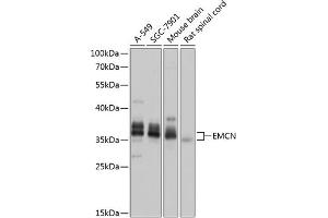Western blot analysis of extracts of various cell lines, using EMCN antibody (ABIN6127867, ABIN6140148, ABIN6140150 and ABIN6218389) at 1:1000 dilution. (Endomucin anticorps  (AA 19-135))