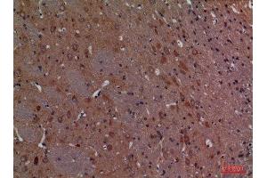 Immunohistochemistry (IHC) analysis of paraffin-embedded Rat Brain, antibody was diluted at 1:100.