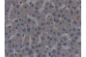 Detection of FAPa in Human Liver Tissue using Polyclonal Antibody to Fibroblast Activation Protein Alpha (FAPa)