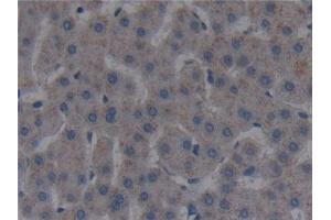 Detection of FAPa in Human Liver Tissue using Polyclonal Antibody to Fibroblast Activation Protein Alpha (FAPa) (FAP anticorps  (AA 523-760))