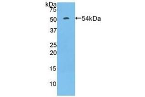 Detection of Recombinant FcgR3A, Rat using Polyclonal Antibody to Fc Fragment Of IgG Low Affinity IIIa Receptor (FcgR3A) (FCGR3A anticorps  (AA 5-241))