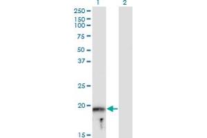 Western Blot analysis of MYLPF expression in transfected 293T cell line by MYLPF monoclonal antibody (M05), clone 3H3. (MYLPF anticorps  (AA 1-169))