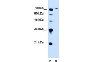 Western Blotting (WB) image for anti-Solute Carrier Organic Anion Transporter Family, Member 6A1 (SLCO6A1) antibody (ABIN2462781) (SLCO6A1 anticorps)