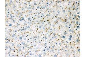 IHC testing of FFPE mouse liver with ABCB11 antibody.