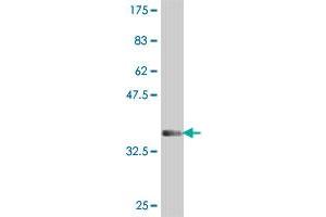 Western Blot detection against Immunogen (35.