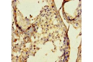 Immunohistochemistry of paraffin-embedded human testis tissue using ABIN7159762 at dilution of 1:100 (MAPRE1 anticorps  (AA 2-268))