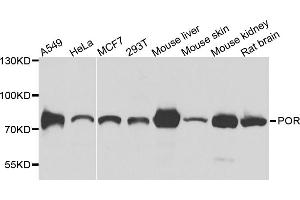 Western blot analysis of extracts of various cell lines, using POR antibody (ABIN5974791) at 1/1000 dilution. (POR anticorps)