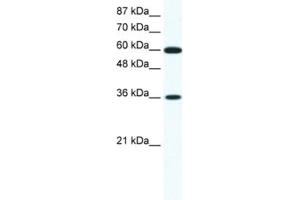 Western Blotting (WB) image for anti-Forkhead Box F1 (FOXF1) antibody (ABIN2460274) (FOXF1 anticorps)