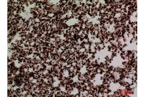 Immunohistochemistry (IHC) analysis of paraffin-embedded Mouse Lung, antibody was diluted at 1:100.