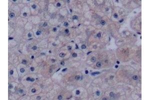 Detection of VEGF165 in Human Liver Tissue using Monoclonal Antibody to Vascular Endothelial Growth Factor 165 (VEGF165) (VEGF 165 (AA 28-191) anticorps)