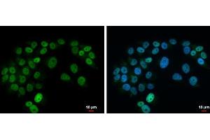 ICC/IF Image Islet 1 antibody detects Islet 1 protein at nucleus by immunofluorescent analysis.