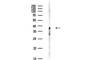 Western blot analysis of lysates from PC12 cells(heat-shock,45 min treatment), using ZNF696 Antibody at 1/1000 dilution.