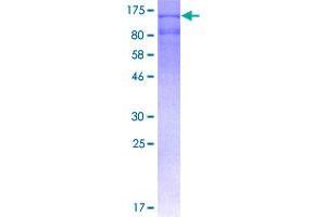 Image no. 1 for Insulin-Degrading Enzyme (IDE) (AA 1-1019) protein (GST tag) (ABIN1307363)