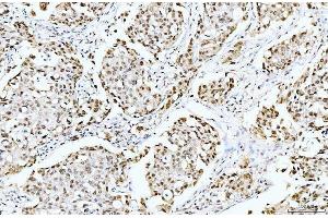 IHC analysis of Cyclophilin E/PPIE using anti-Cyclophilin E/PPIE antibody (ABIN7599242). (PPIE anticorps  (AA 1-301))